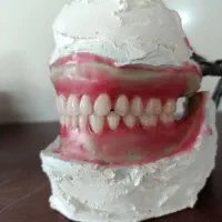 پروتز متحرک دندان|آرایشی، بهداشتی، درمانی|گنبد کاووس, |دیوار