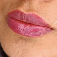 ژل \بوتاکس \لیزر مطب صدف (رویال سابق)