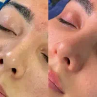 فیشال و پاکسازی ۱۳۰