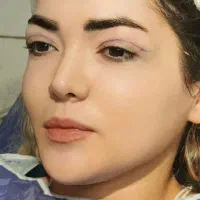 مدل بلفارو پلاستی لیفت ابرو کاشت ابرو سانترال لب|خدمات آرایشگری و زیبایی|تهران, پونک|دیوار