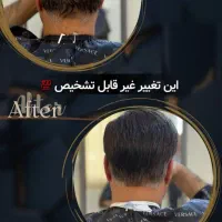 پروتز و ترمیم موی افشان|خدمات آرایشگری و زیبایی|مشهد, کوثر|دیوار