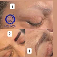 مدل رایگان ریموو تاتو قدیمی|خدمات آرایشگری و زیبایی|قشم, |دیوار
