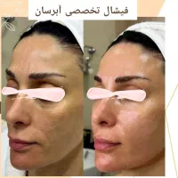 در یک جلسه تفاوت حس کنید (فیشال و پاکسازی پوست)