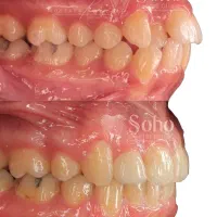 ارتودنسی دندان|خدمات آرایشگری و زیبایی|شیراز, شهرک ولیعصر|دیوار