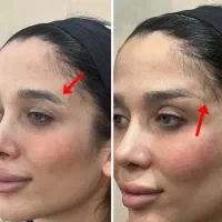 مدل خدمات زیبایی پزشکی در درمانگاه جهت تکمیل پیج|خدمات آرایشگری و زیبایی|اهواز, پادادشهر|دیوار
