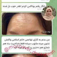 جوانسازی بیومیتیک بدون کار های تهاجمی|آرایشی، بهداشتی، درمانی|تهران, نگین غرب|دیوار