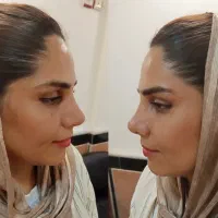 ظرفیت جمعه عمل بینی  دکتر خلیلی  با ۳۵ م