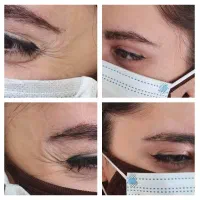 تزریق ژل و بوتاکس توسط پزشک با قیمت قبل