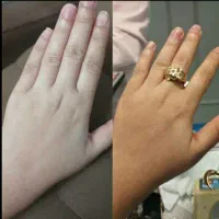 فروش کرم برغ وطلا اصل اصل اصل
