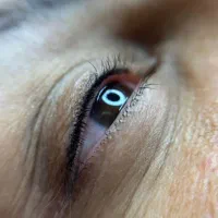 بن مژه رایگان