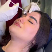 تخفیف ویژه بوتاکس دکتر کامبیز محمدپور (ایرانا)