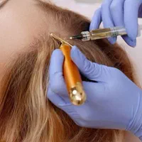 پی آر پی مو،مزوتراپی،همراه با آنالیز مو توسط پزشک