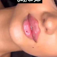 جشنواره ژل و بوتاکس و مزوژل|خدمات آرایشگری و زیبایی|تهران, ظفر|دیوار