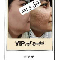 کرم وی آی پی