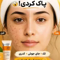 کرم بیوممتیک اصلی باقیمت خیلی عالی