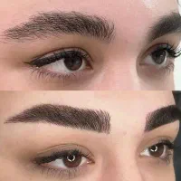 آموزش و خدمات میکروبلیدینگ فیبروز