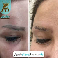 پاک کردن تتو خالکوبی،ریموو تتو ابروـ بدن مایابیوتی|خدمات آرایشگری و زیبایی|یاسوج, |دیوار