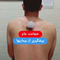 بانوی حجامت یزد