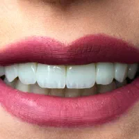 نیازمند دستیار دندانپزشکی