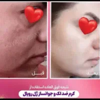 ژل کرم رویال|آرایشی، بهداشتی، درمانی|نورآباد ممسنی, |دیوار