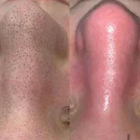 فیشیال، پلاسماو الکترولیز، لاغری فقط خانم ها|خدمات آرایشگری و زیبایی|اصفهان, عسگریه|دیوار