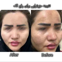 جشنواره تخفیف خدمات پوستی(فیشال،پاکسازی،کربوکسی)|خدمات آرایشگری و زیبایی|بیرجند, |دیوار