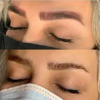 ریموو و پاک کردن تخصصی تاتو توسط مستر ریموو