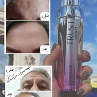 کرم و سرم سگانه هوشمند|آرایشی، بهداشتی، درمانی|مشهد, ولیعصر (امامیه)|دیوار