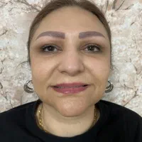 فیلر بوتاکس جوانساز جراحی بادی نخ مزو هیرفیلر|خدمات آرایشگری و زیبایی|تهران, پاسداران|دیوار