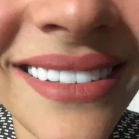 کارگاه ساخت دست دندان مصنوعی و لمینیت|خدمات زیبایی و سلامت|تهران, شهرک شریعتی|دیوار