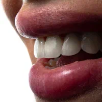 مرکز دندانپزشکی دکتر پریسا جعفری