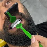 زیبایی دندان ..