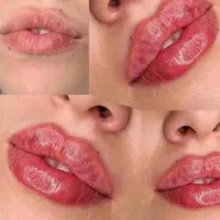 فیلرزیر چشم، زاویهفک، لیفت شقیقه، بوتاکس، لب نچرال|خدمات آرایشگری و زیبایی|مشهد, سرافرازان|دیوار