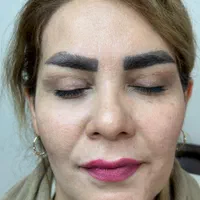 بلفارو پلاستی بالا و پایین|خدمات آرایشگری و زیبایی|تهران, شهران جنوبی|دیوار