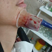 حجامت،زالو‌درمانی، فصدخون،طب سوزنی،مزاج شناسی|خدمات آرایشگری و زیبایی|تهران, بیسیم|دیوار