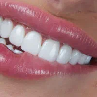 دنداسازی البرز