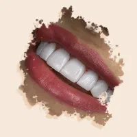 کامپوزیت تمام اقساط