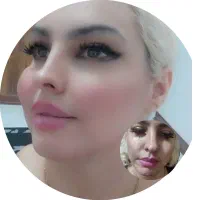 خدمات زیبایی ژل و بوتاکس|خدمات آرایشگری و زیبایی|اردبیل, |دیوار