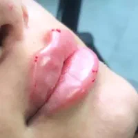افتتاح کلینیک زیبایی دکتر سیفوری با ۱۰سال سابقه|خدمات آرایشگری و زیبایی|قرچک, مهدیه|دیوار