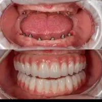 کلینیک تخصصی دندانپزشکی و ایمپلنت با اقساط بلندمدت