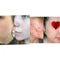 کرم تضمینی صورت معجزه|آرایشی، بهداشتی، درمانی|خاش, |دیوار