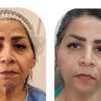 جراحی صورت ۵۰درصد تخفیف|خدمات آرایشگری و زیبایی|تهران, دروس|دیوار