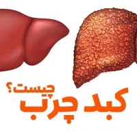 بهبودی کبد چرب