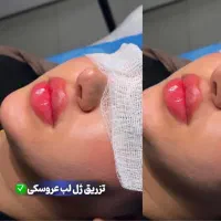 خدمات ژل عربی ‌خلیجی زیبادرکلینیک|خدمات آرایشگری و زیبایی|پرند, فاز ۵|دیوار