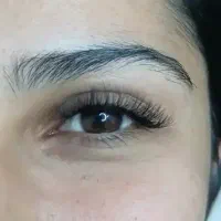 کاشت مژه