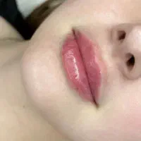 انواع خدمات زیبایی مجهز به دستگاه درمان لک