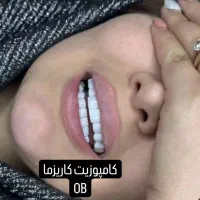 لمینت وکامپوزیت|خدمات آرایشگری و زیبایی|دورود, |دیوار