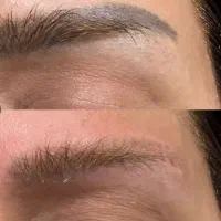 ریموو تک جلسه ای به صورت حرفهای+میکرو شیدینگ بنمژه