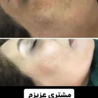 صابون وکرم فروشی|آرایشی، بهداشتی، درمانی|سرخنکلاته, |دیوار