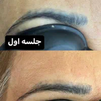 خدمات ریمو تتو،رفع کک و مک کلینک دکتر شریفی|خدمات آرایشگری و زیبایی|فولادشهر, B4|دیوار